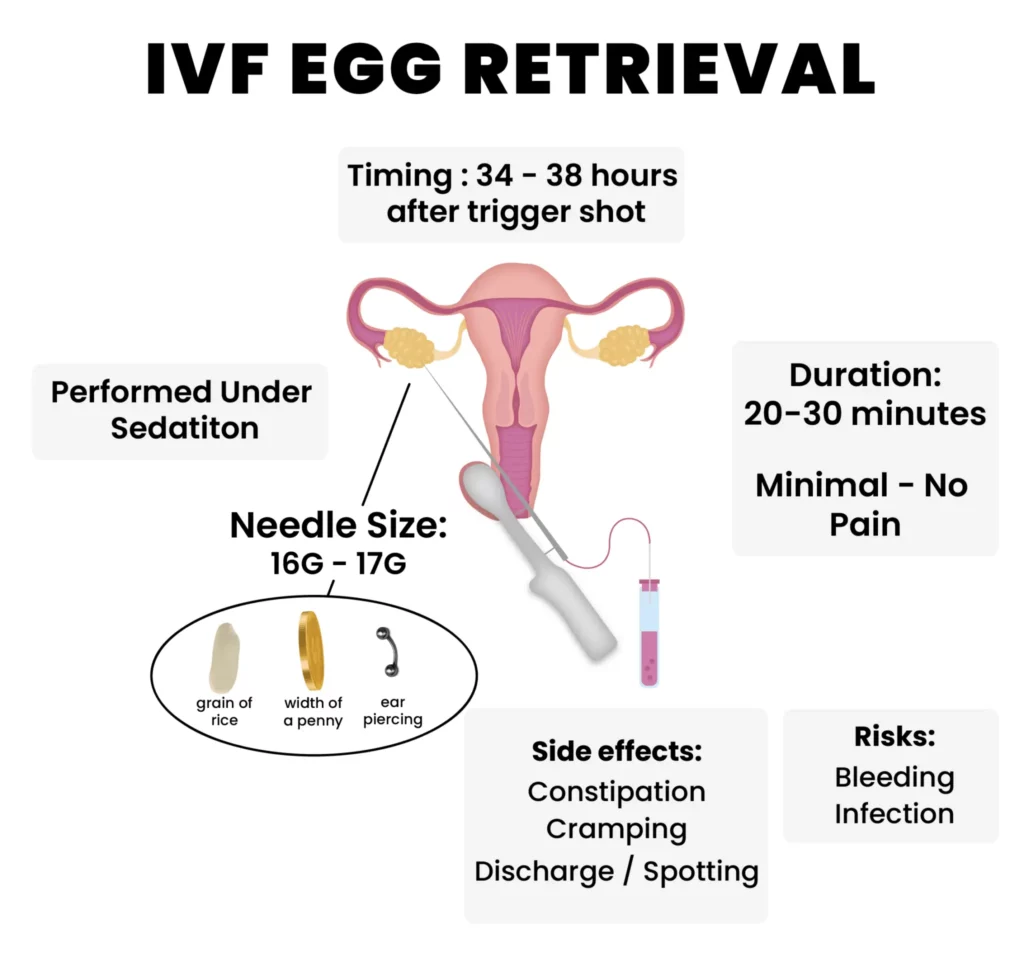 Ivf Egg Retrieval