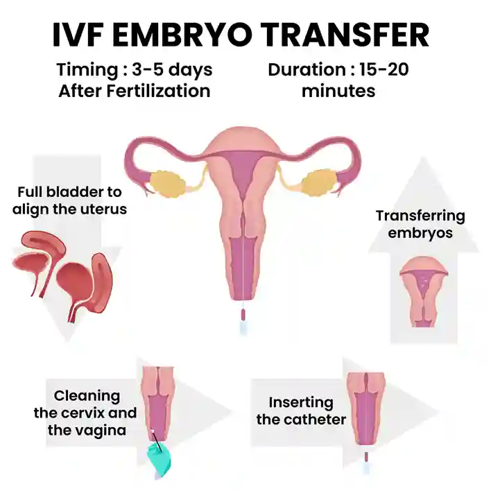 Ivf Embryo Transfer