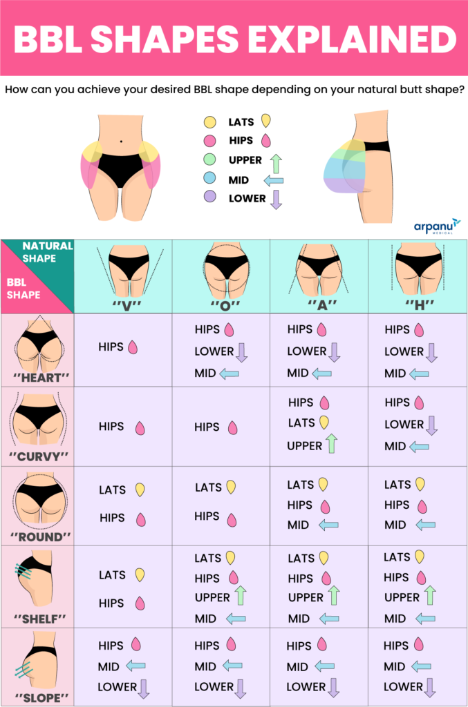 Bbl Shapes, Bbl Shape, Bbl After Shape, Bbl Before After, Bbl Arpanu Medical