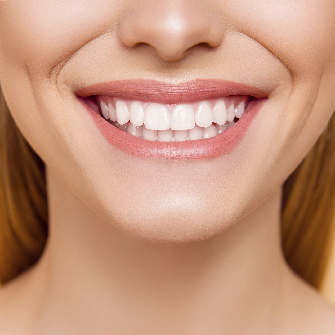 Hollywood Smile