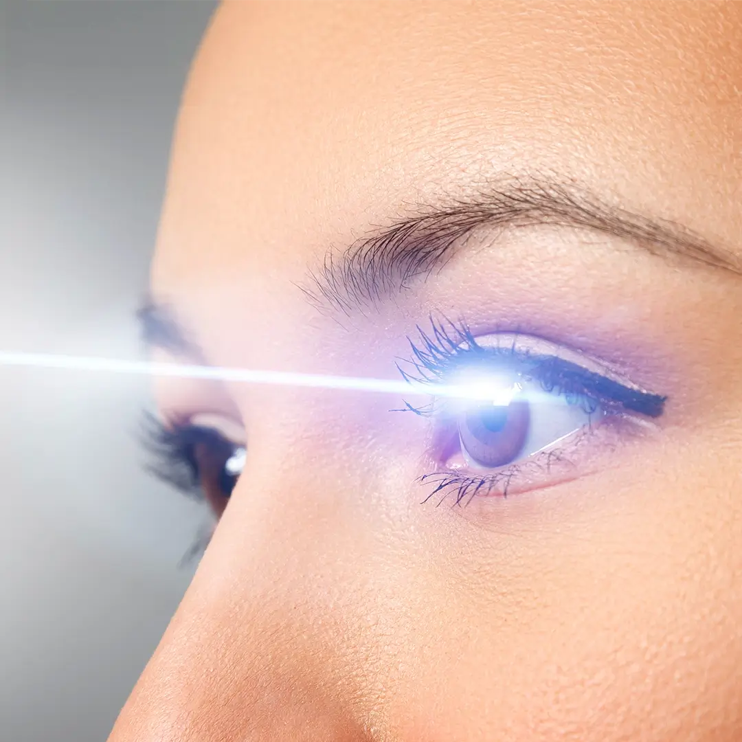Lasik In Turkey 4