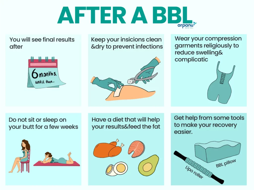 An Infographic Of After Bbl