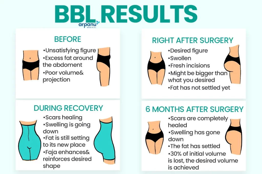 BBL Powerful Oil With Fenugreek & Akpi Seed – Natural Oil For Butt & Hip Enlargement, 4 Oz