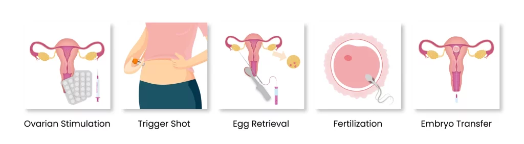 An Infographic About Ivf Procedure Steps