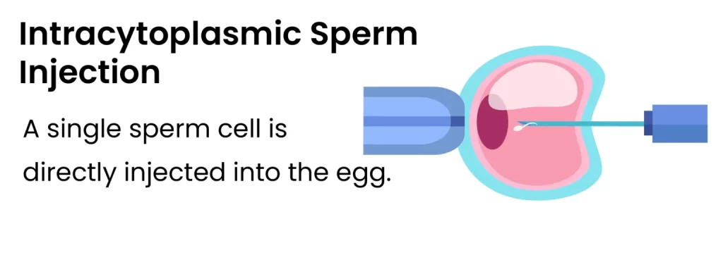 Intracytoplasmic Sperm Injection