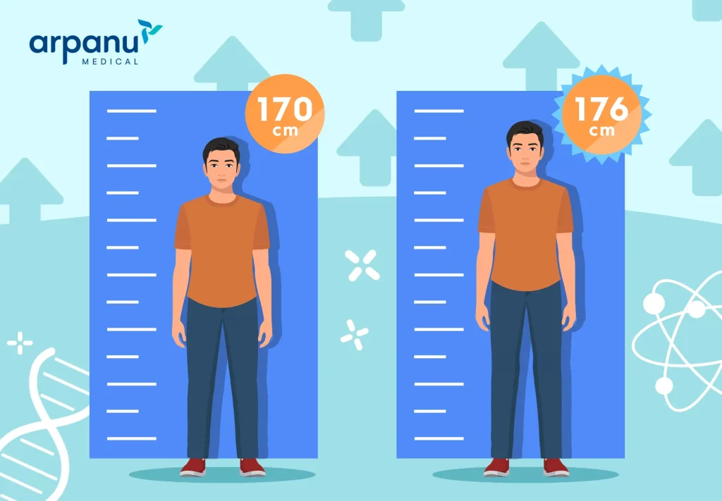 An Infographic Of Limb Lenghtening