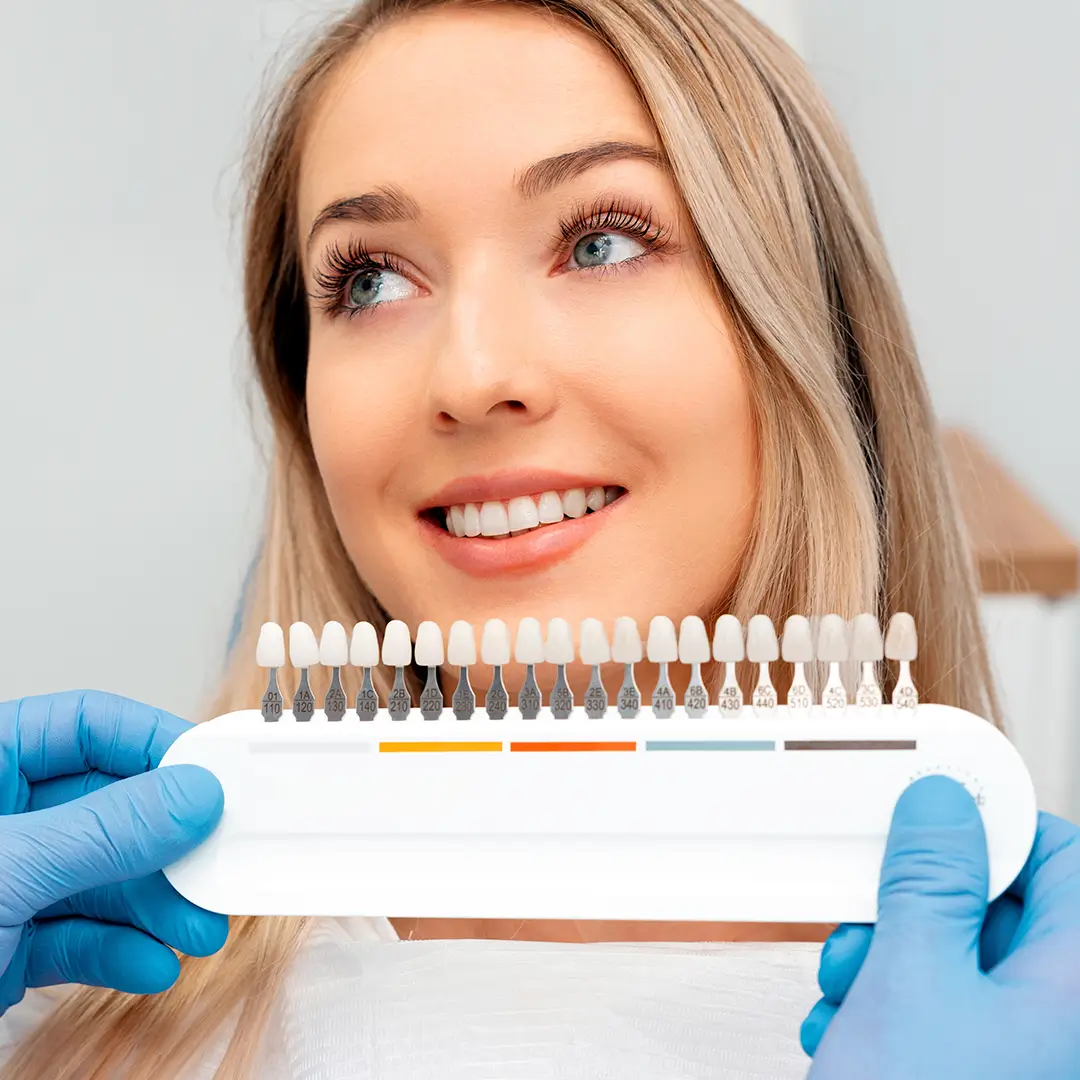 A Hand Holding A Teeth Palette With Different Shades Of Veneers In Front Of A Smiling Young Woman