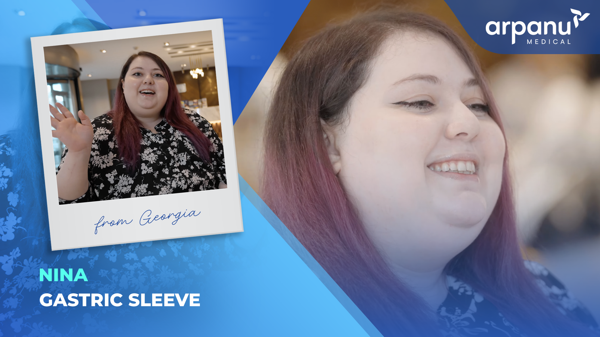 Nina.gastric Sleeve