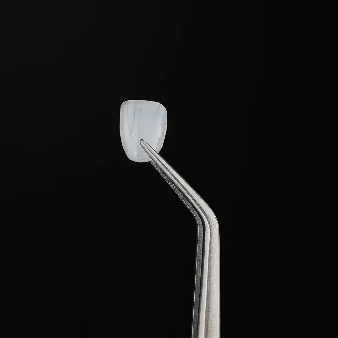 Minimally Invasive No-Prep Veneers