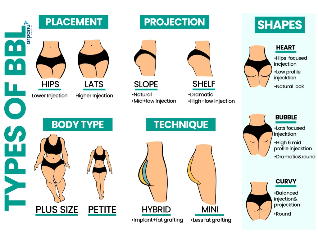 An Infographic That Shows The Types Of Bbl