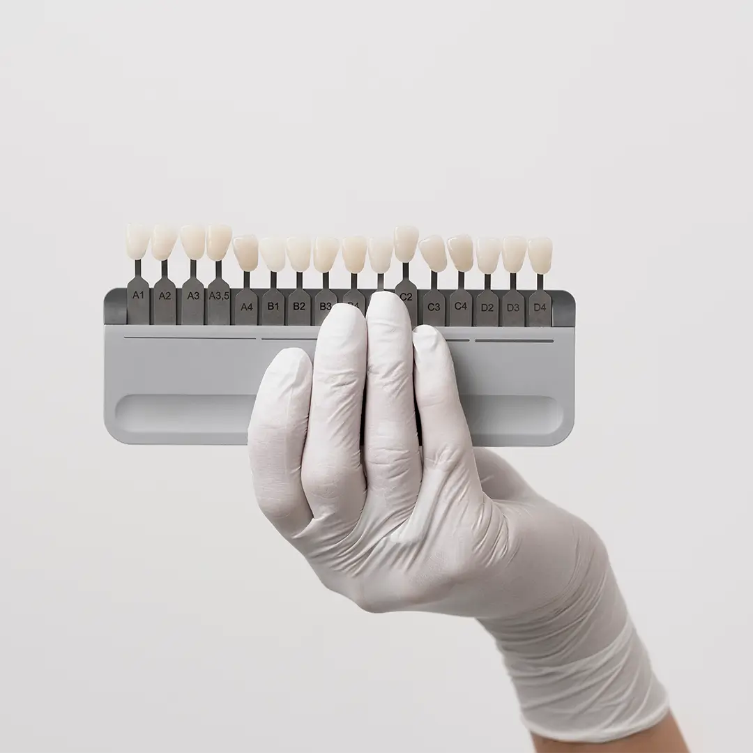 A Hand Holding A Teeth Palette With Different Shades Of Veneers