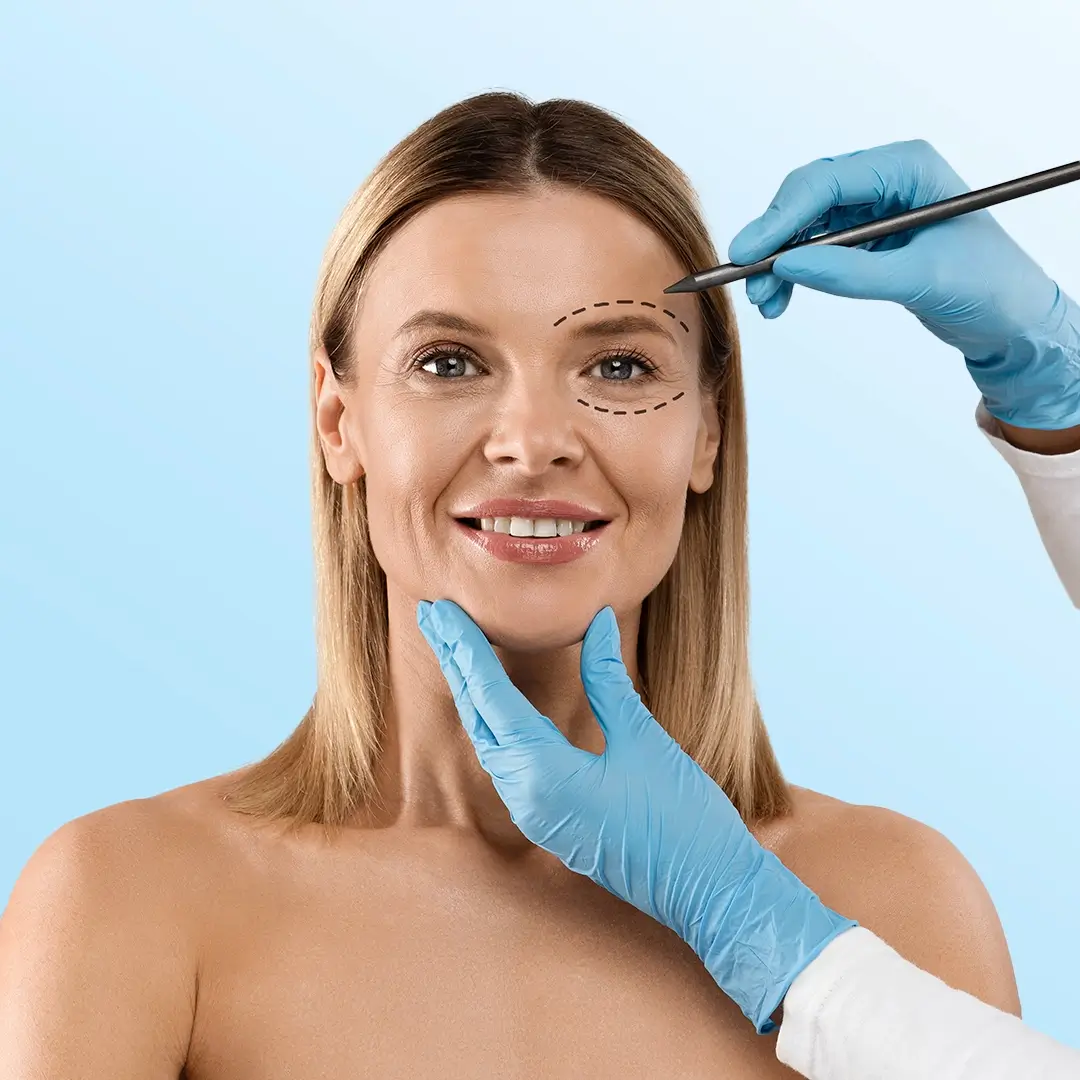 Upper And Lower Eyelid Surgery In Turkey