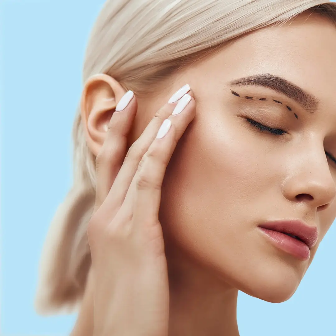 Blepharoplasty-In-Turkey