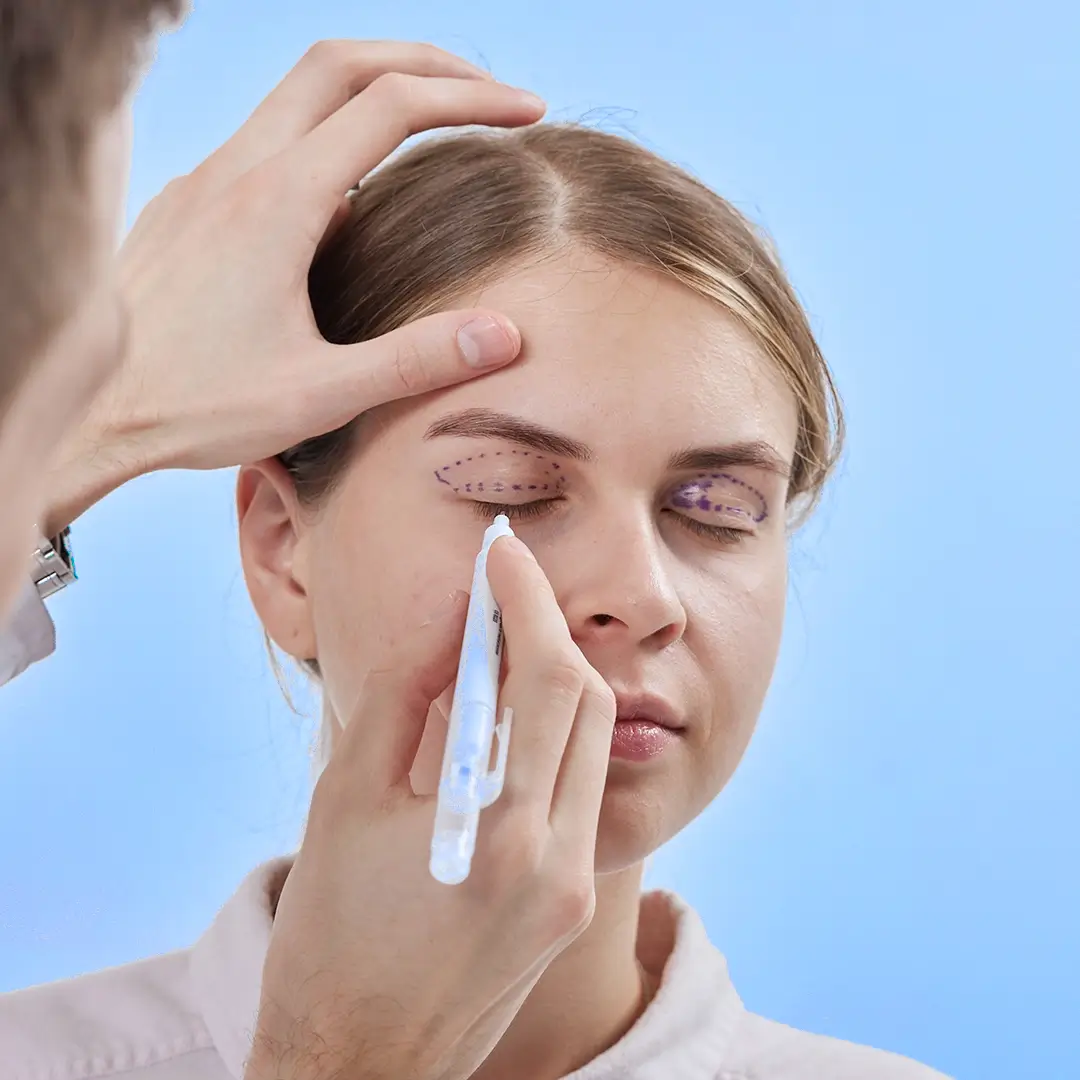 Beautifying Your Eyes With Eyelid Surgery In Turkey