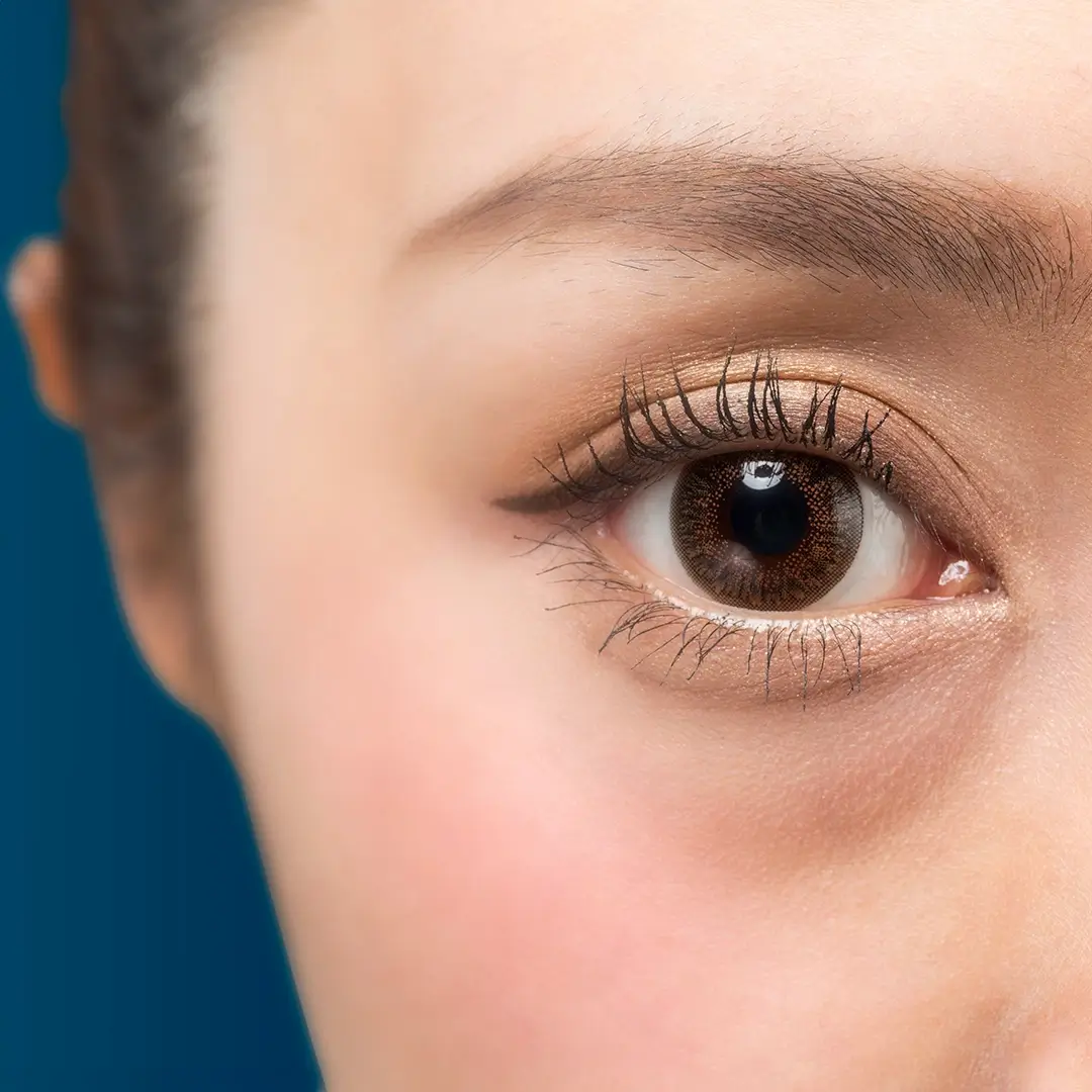 Asian Eyelids (Both Upper And Lower Eyelids