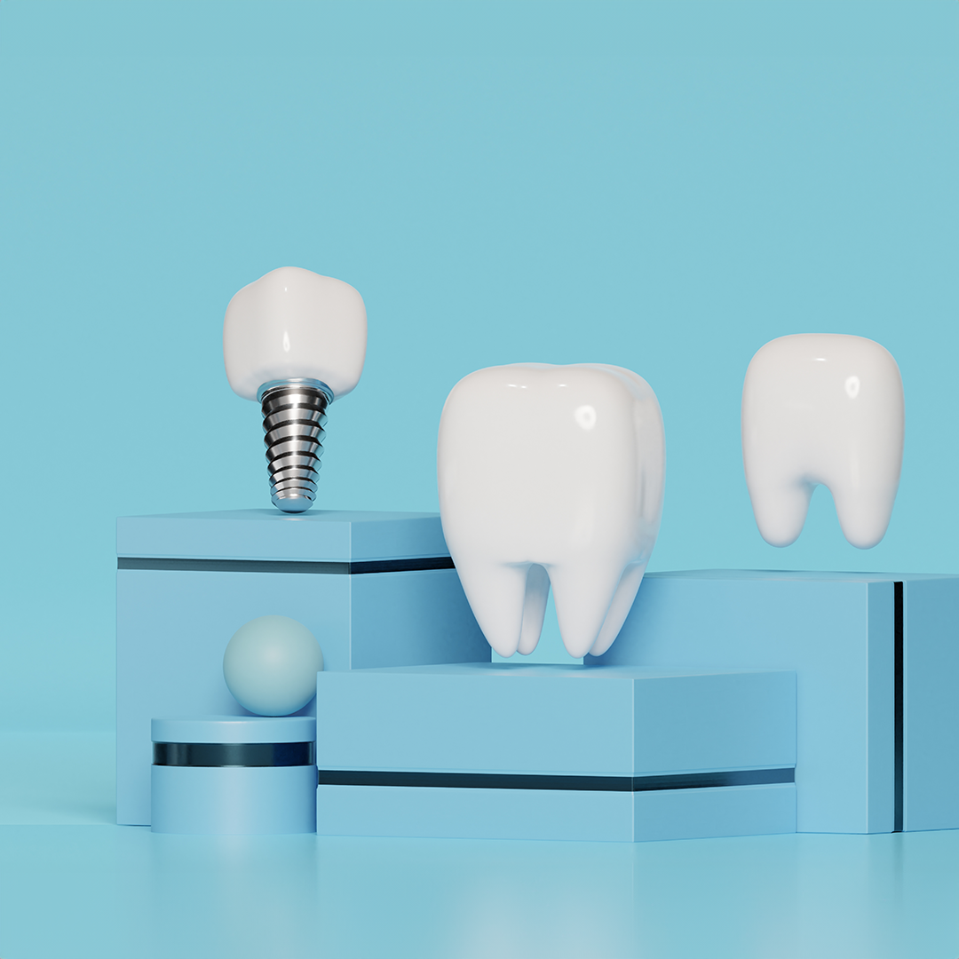 Dental Implants In Turkey 5