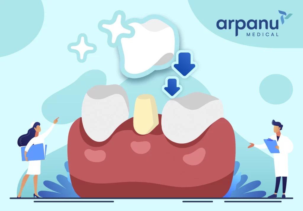 Crowns Dental Treatment In Istanbul Arpanu Medical