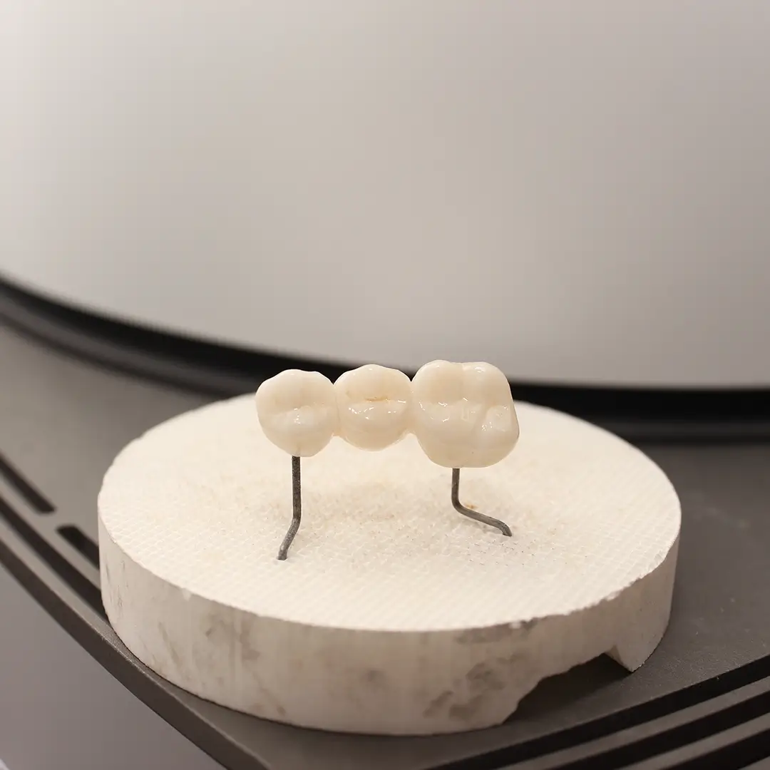 Zirconia Crowns