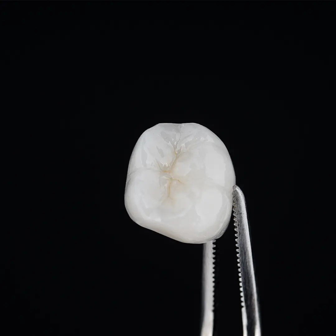 Porcelian-Fused-To-Metal Crowns