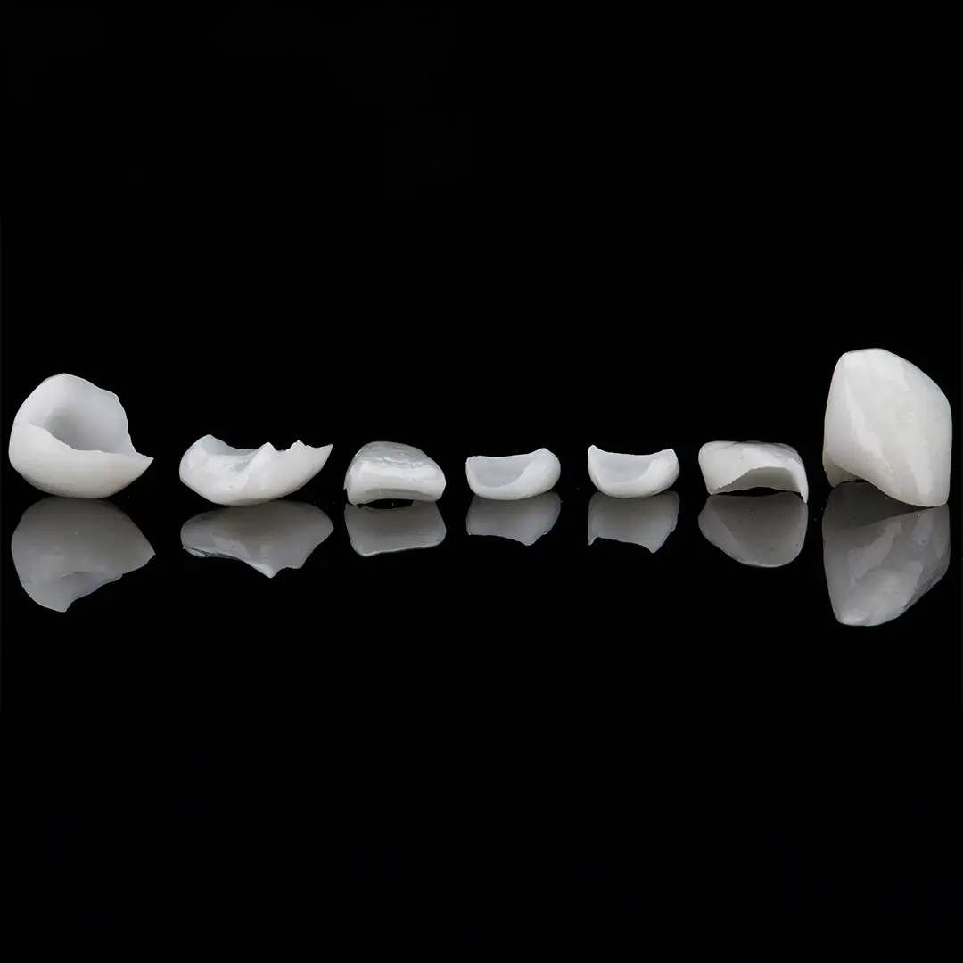 Dental-Crowns-In-Turkey (9)