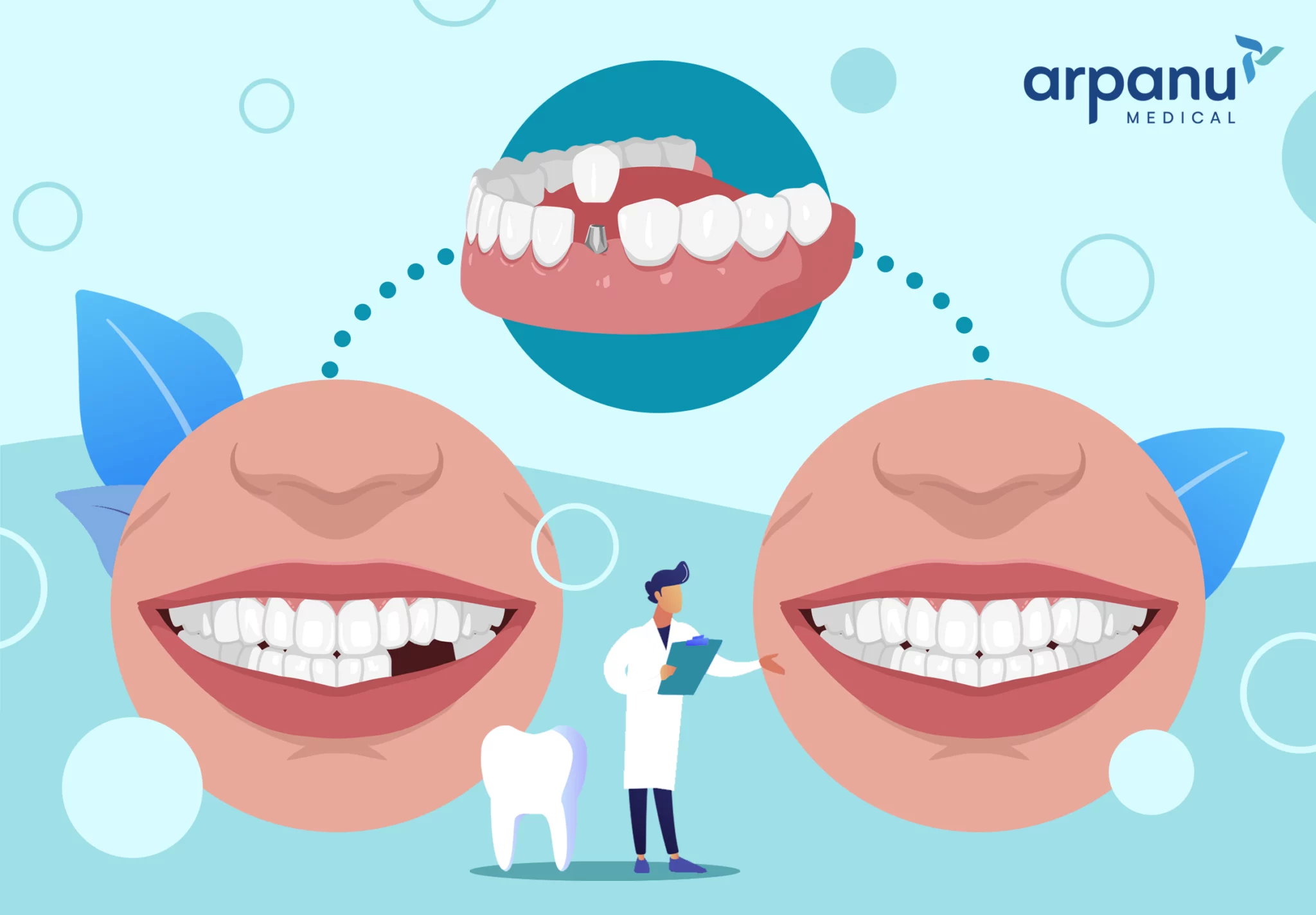 An Infographic Of Dental Implants
