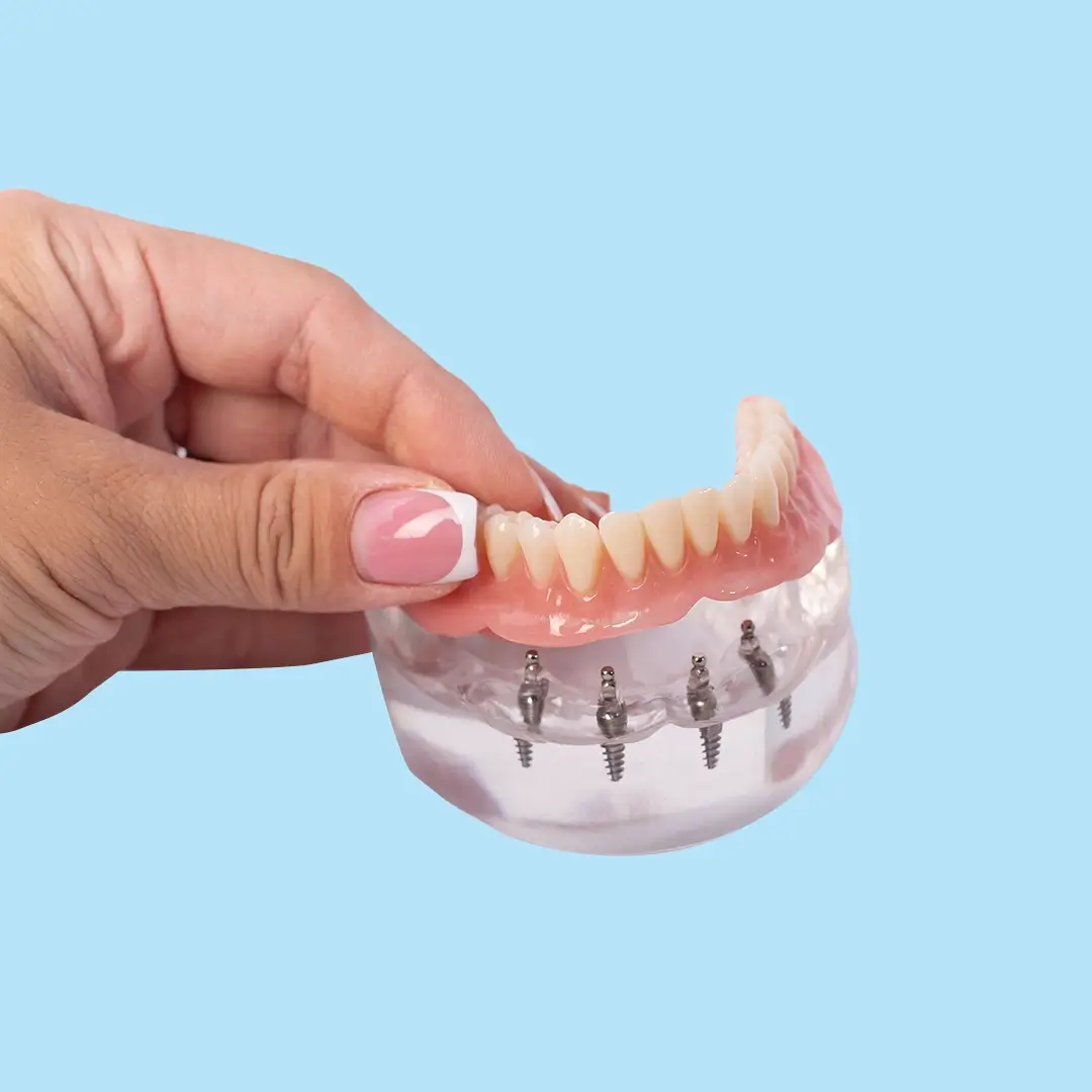 Dentures In Turkey 5