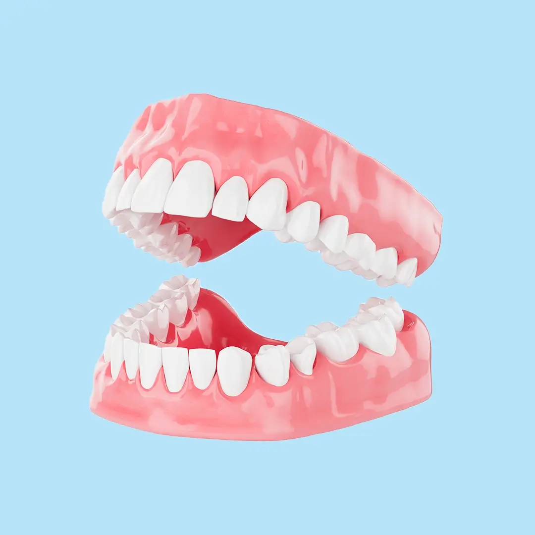 Dentures In Turkey 6