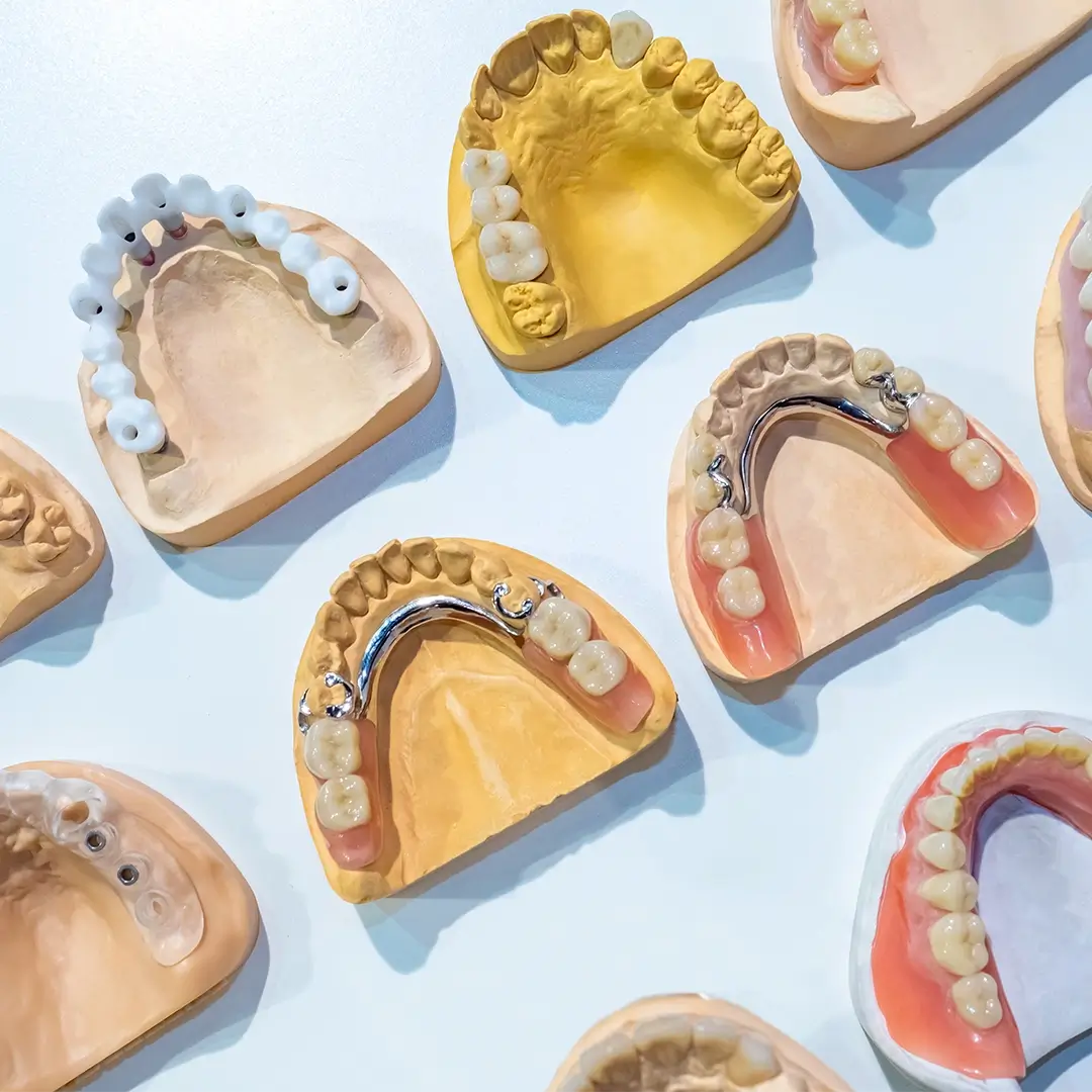 Dentures In Turkey 8