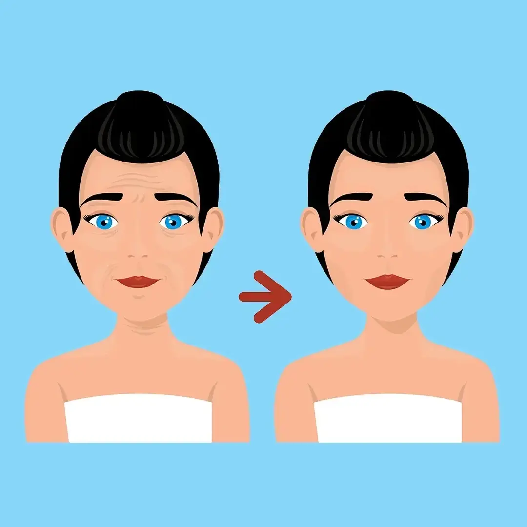 Facelift In Turkey Change