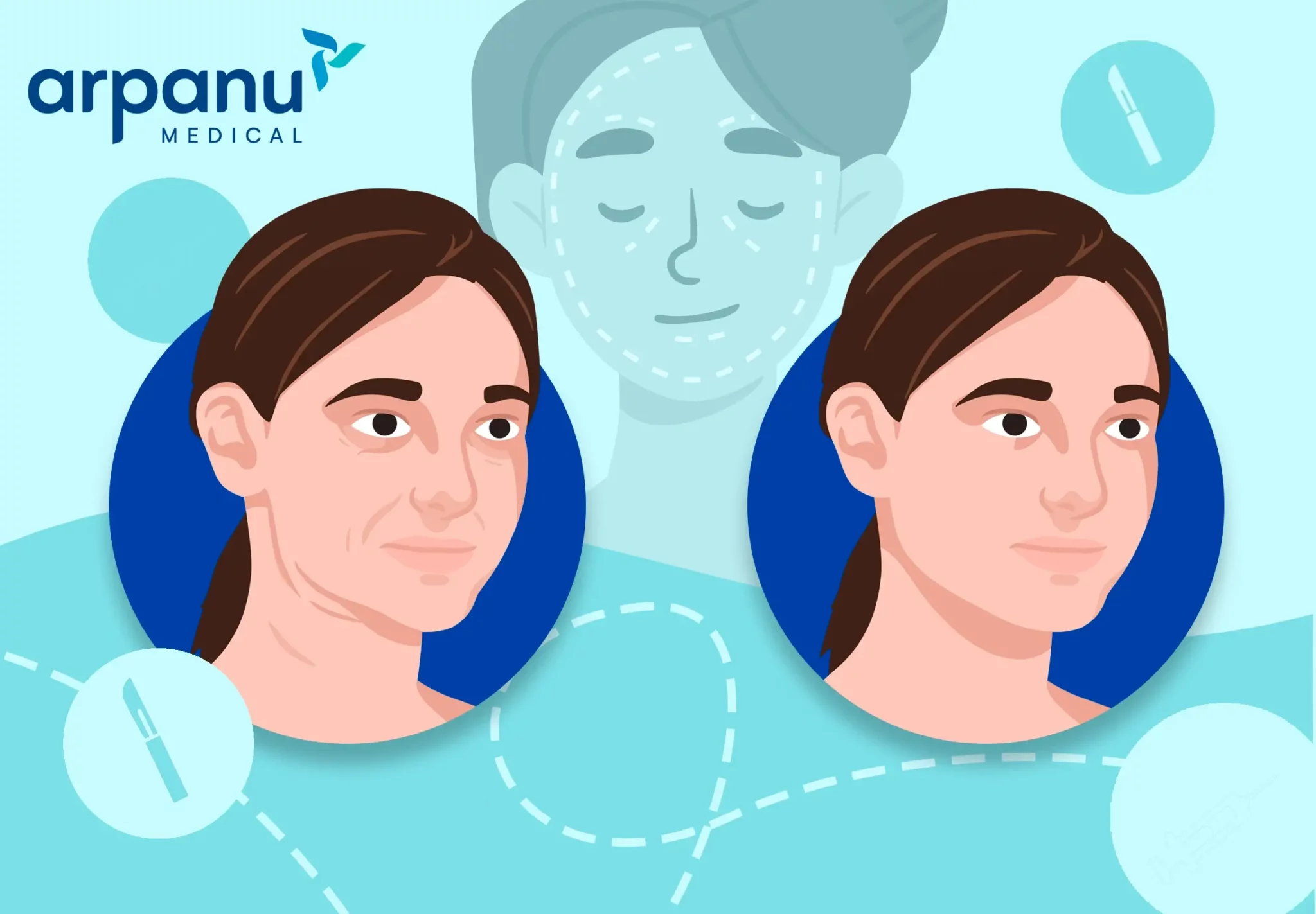 A Facelift Infographic