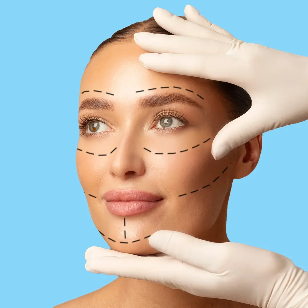 Facelift In Turkey 8
