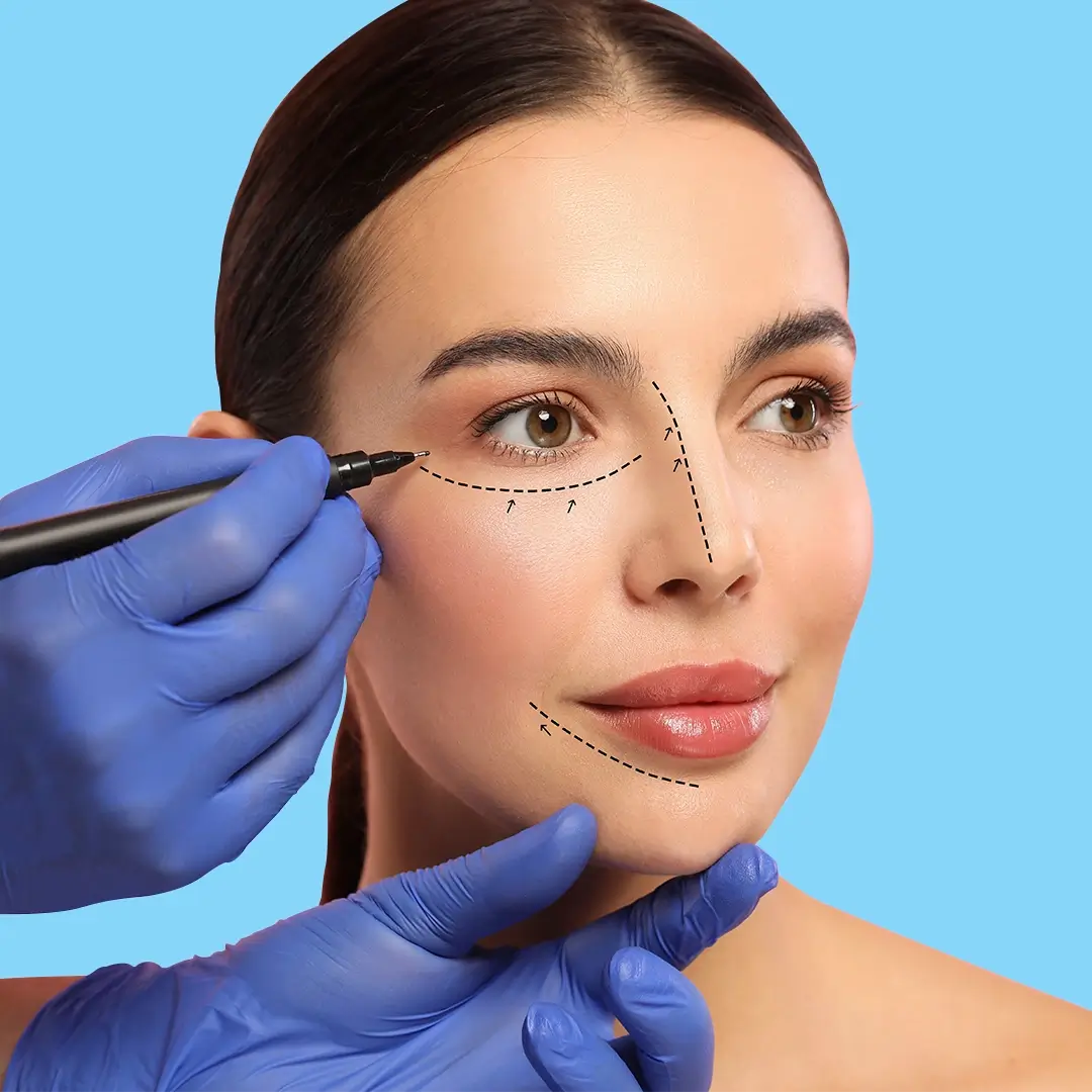 Facelift In Turkey 9