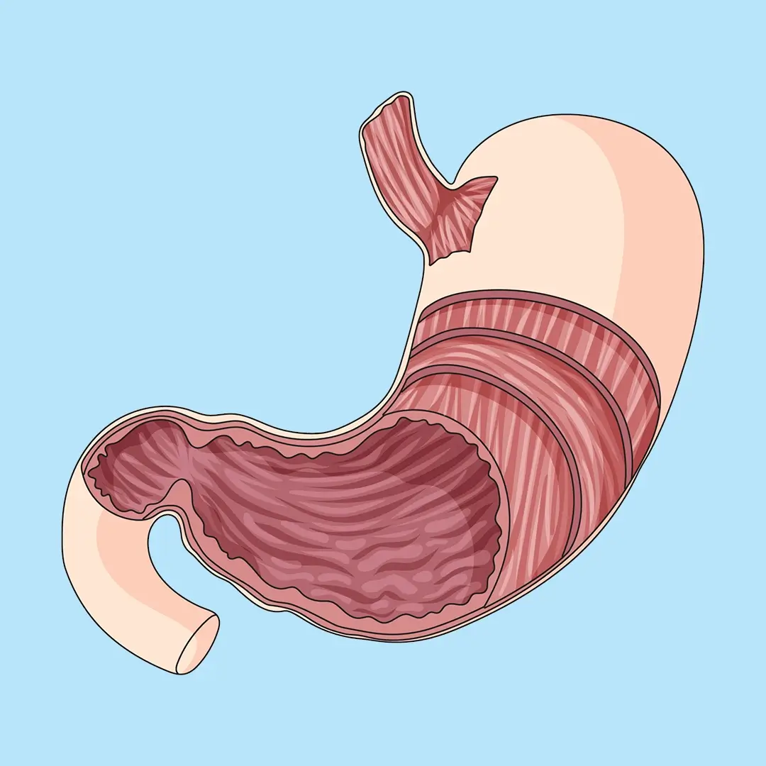 An Illustration Of A Stomach