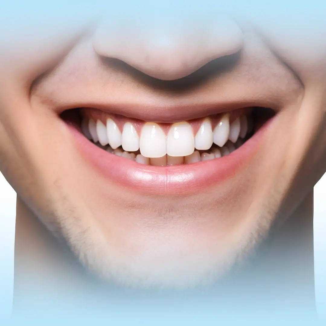 An Image Of A Young Man Smiling With His Teeth Seen