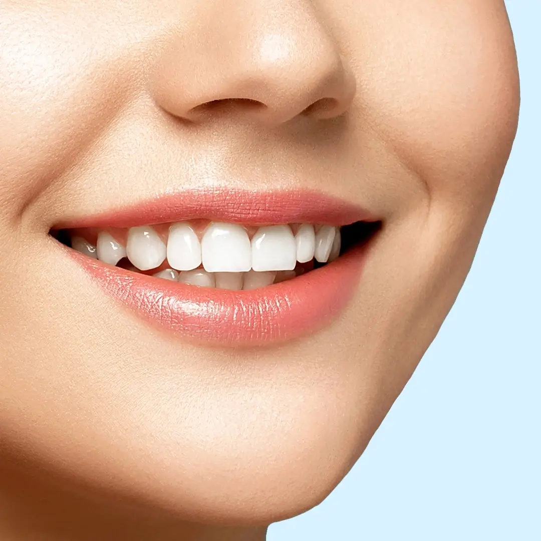 Hollywood Smile In Turkey 8