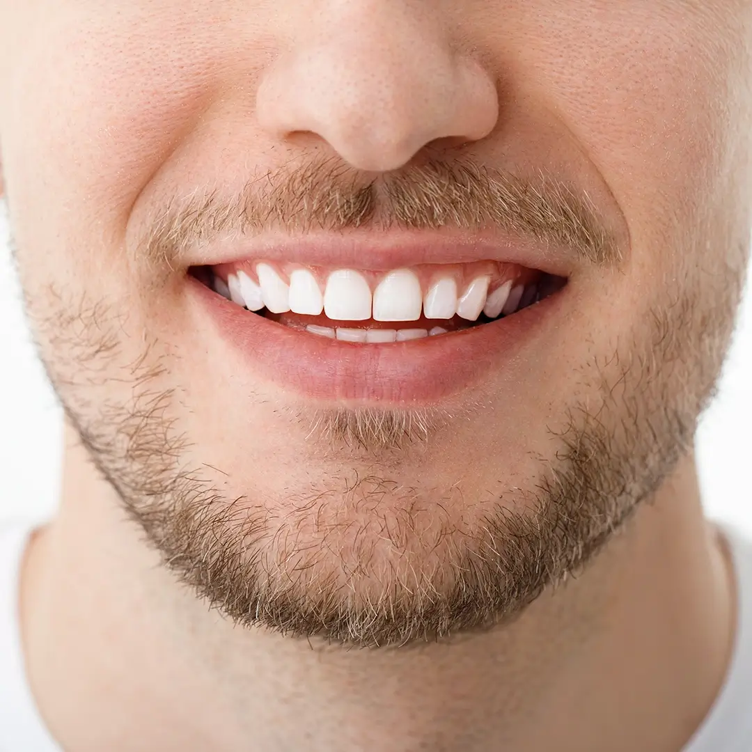 An Image Of A Man'S Face Seen In Half, With His Teeth Seen