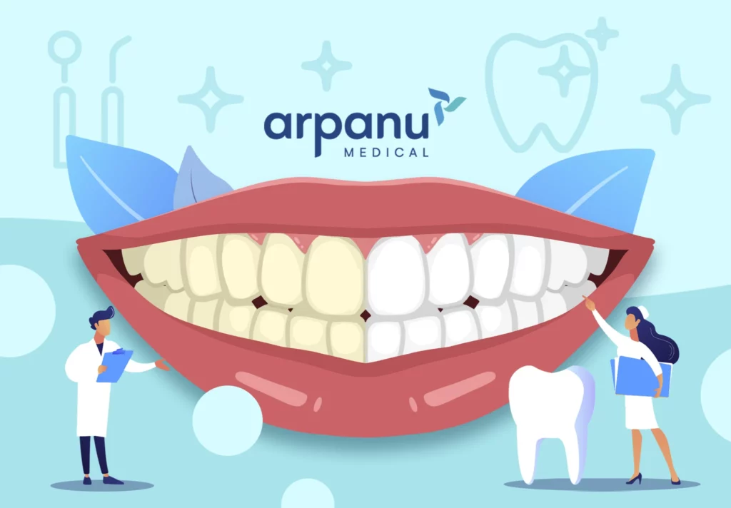 Teeth Whitening In Turkey With Arpanu Medical