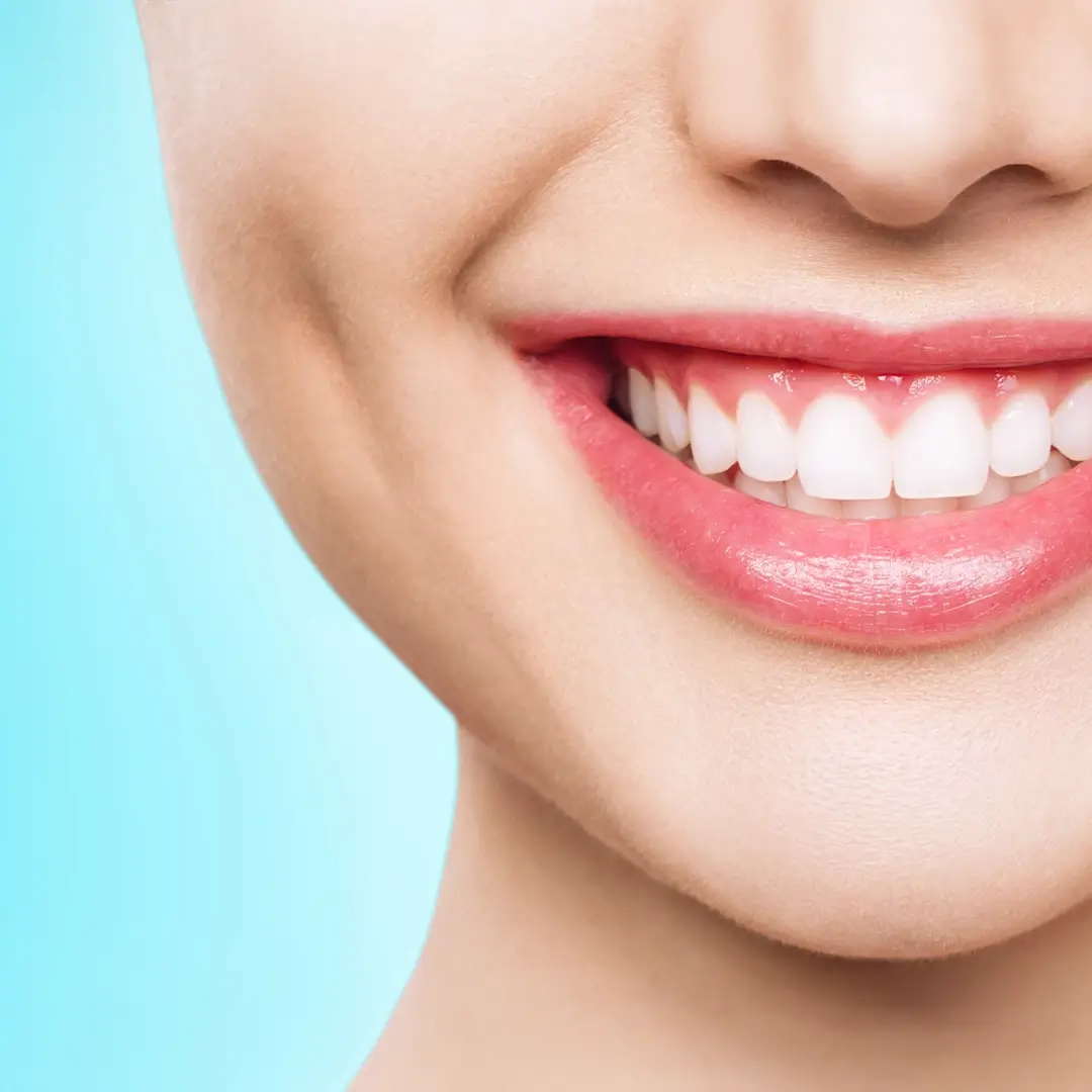 Teeth-Whitening-In-Turkey (2)