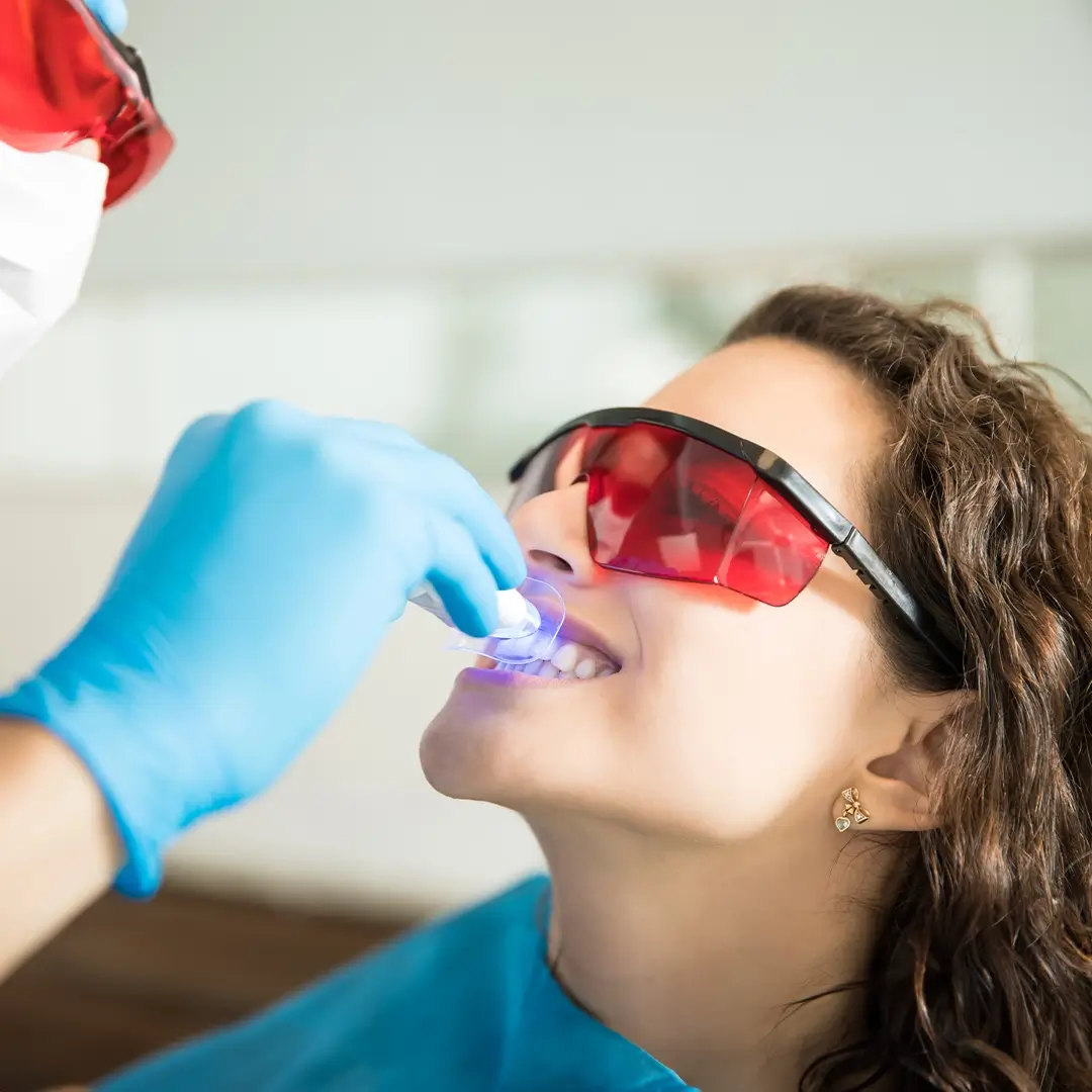 An Image Of A Woman Having A Whitening Gel Applied On Her Teeth By The Dentist With The Aid Of A Special Light