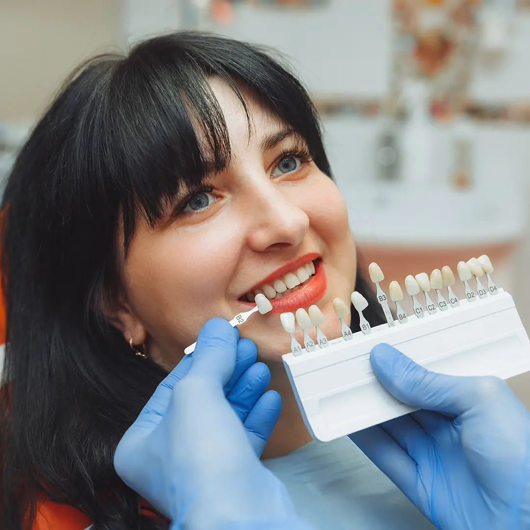 Teeth-Whitening-In-Turkey