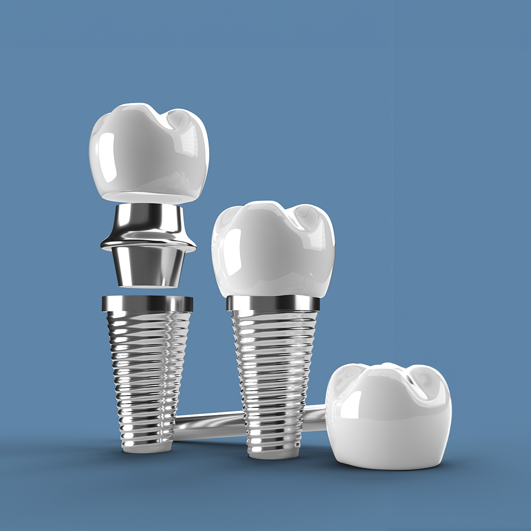 Dental Implants In Turkey 4