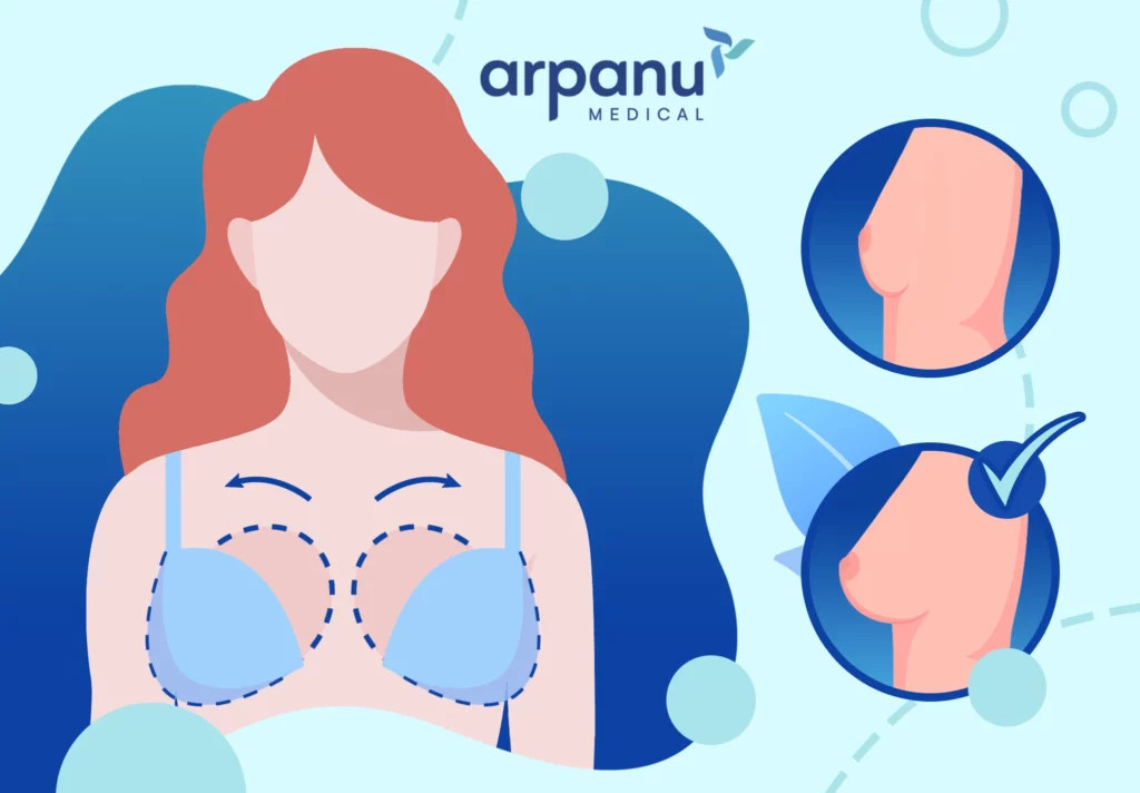 Breast Augmentation At Arpanu Medical