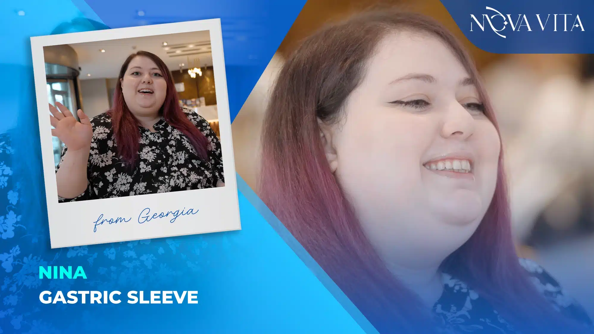 Nina.gastric Sleeve 1